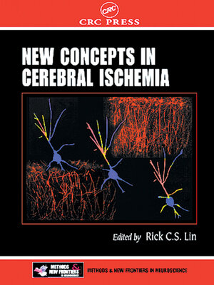 cover image of New Concepts in Cerebral Ischemia